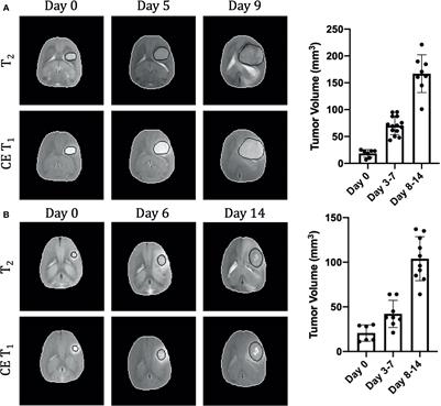 Frontiers | Imaging Hallmarks Of The Tumor Microenvironment In ...